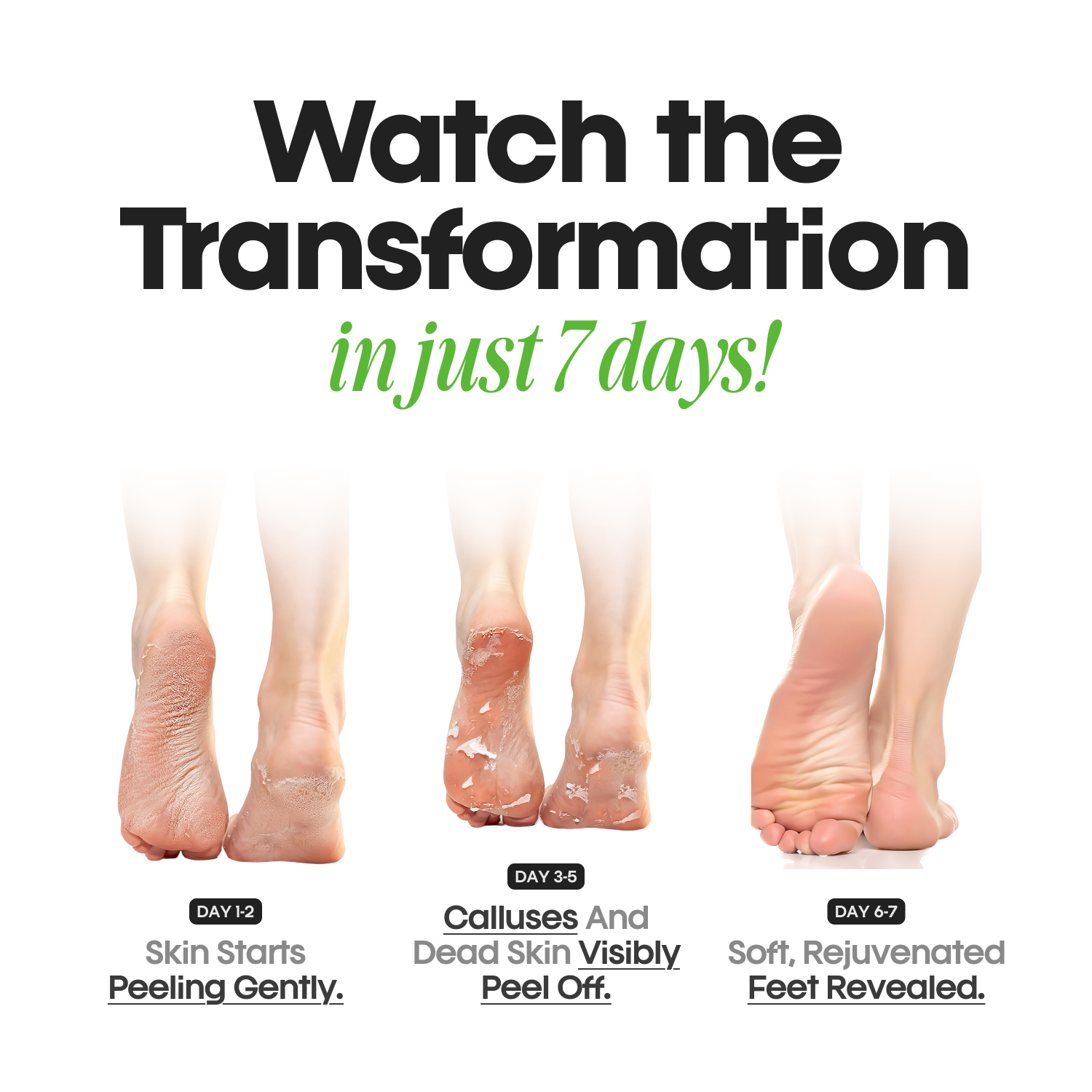 Result from tea tree pedicure foot mask